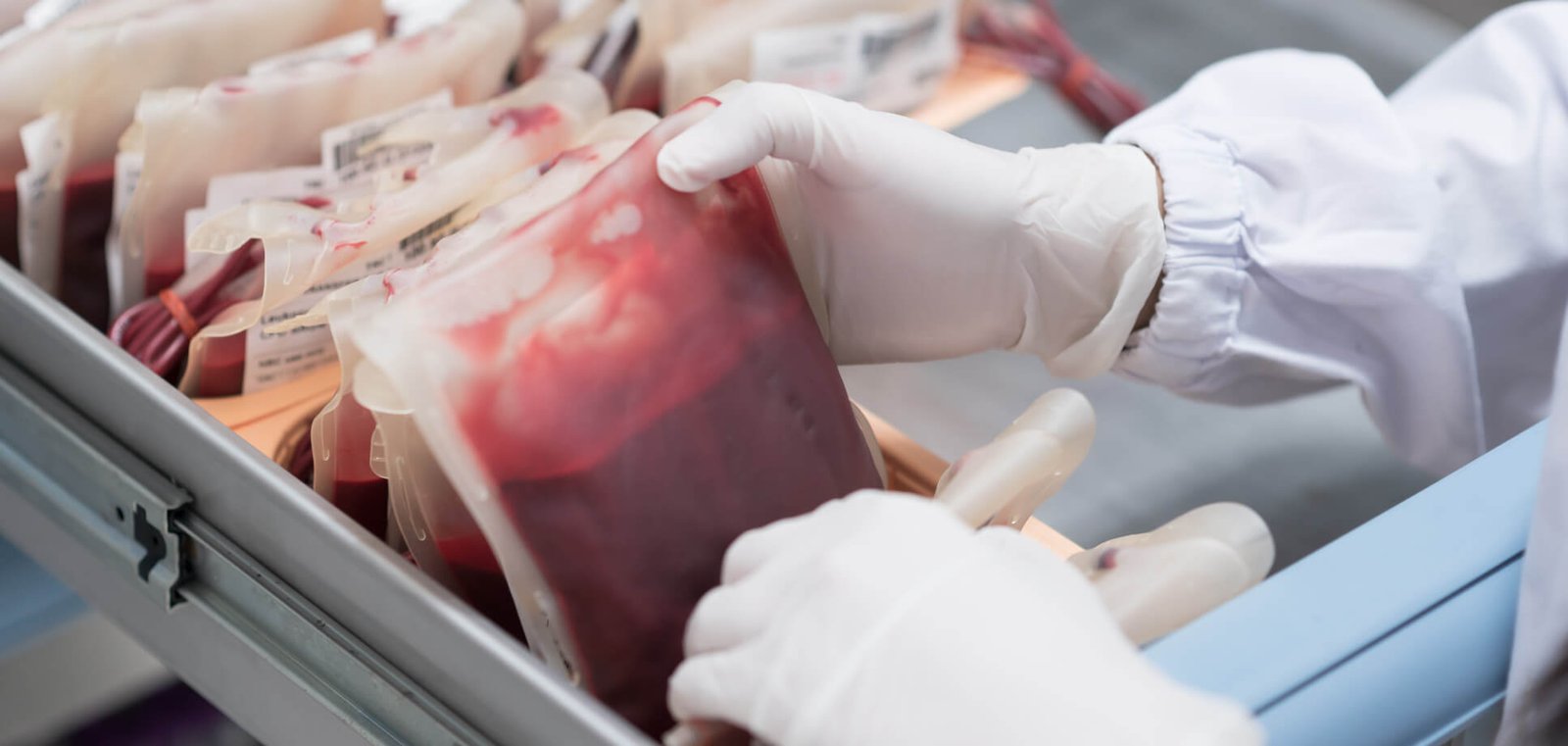 Maintenance of Blood Bank Refrigerator